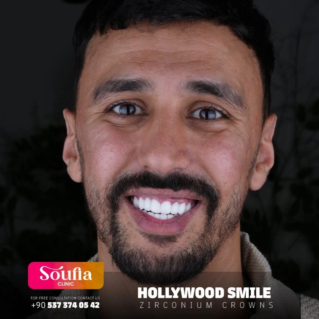Hollywood Smile
